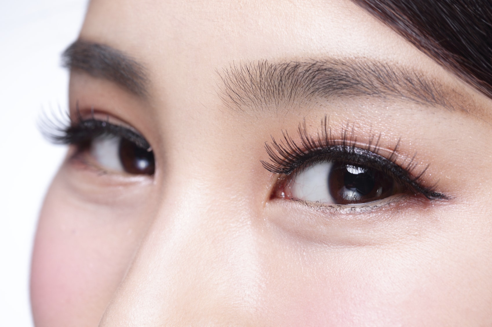 Asian Blepharoplasty Newport Beach, CA