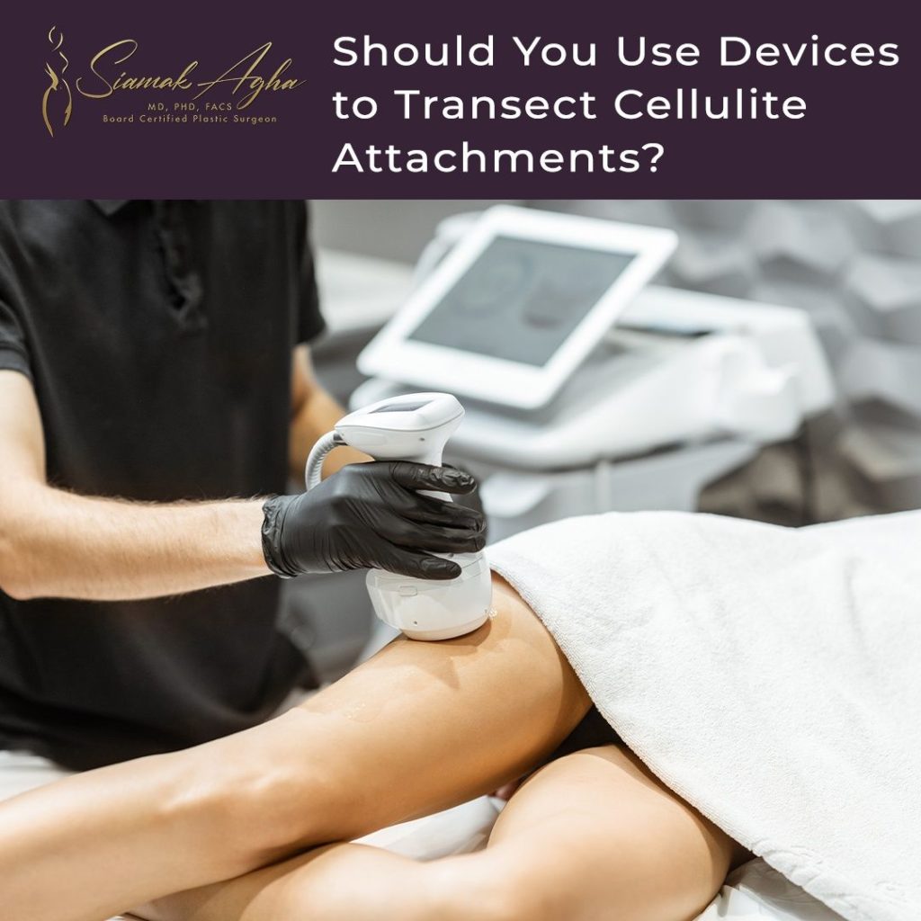 Should You Use Devices to Transect Cellulite attachments? Instagram Post