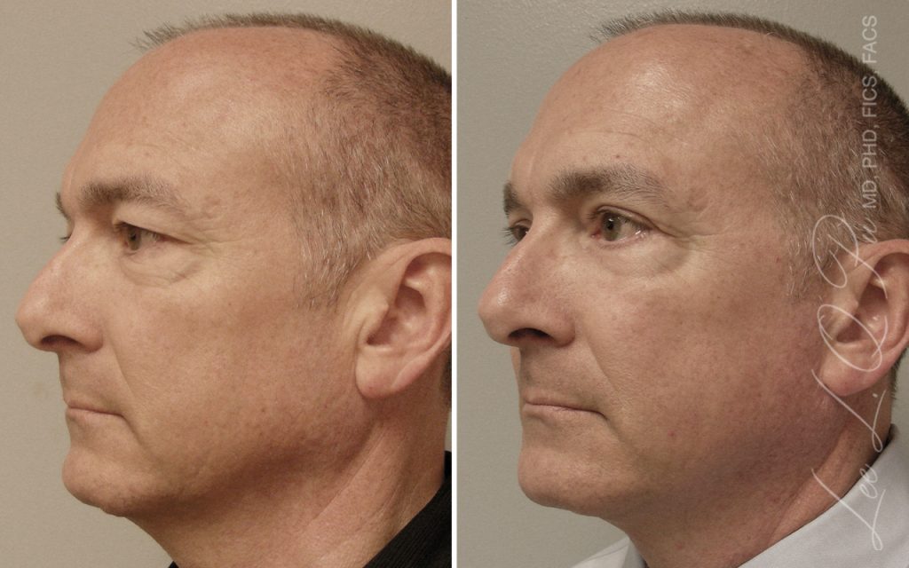 Dr. Pu&#8217;s Before and After Photos